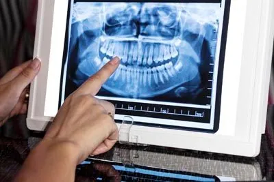 3D digital x-rays used at Contemporary Dental Arts